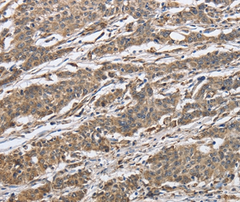 IPO7 Antibody