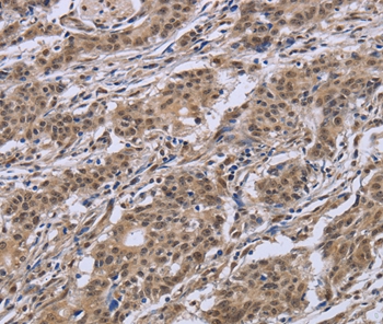 IPO8 Antibody