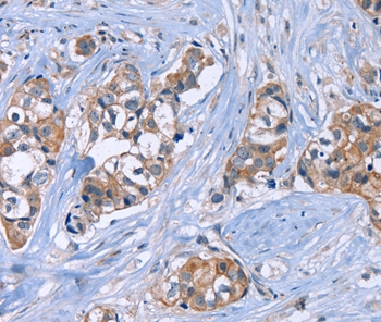 JAG1 Antibody