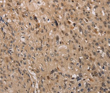 KDM4A Antibody