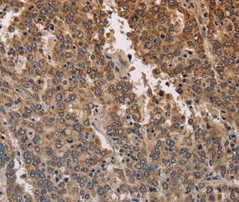 KCNK9 Antibody