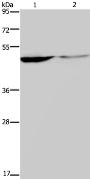 KCNK9 Antibody