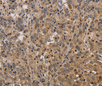 ELAVL2 Antibody