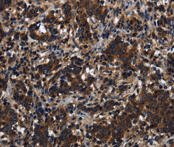 KLHL8 Antibody