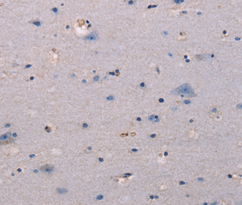 KSR1 Antibody
