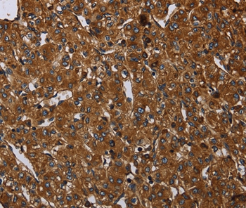 ARHGEF12 Antibody