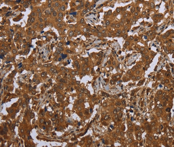 SCGB1D2 Antibody