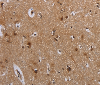 MTBP Antibody