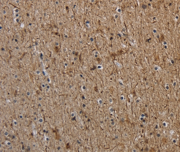 NEFH Antibody