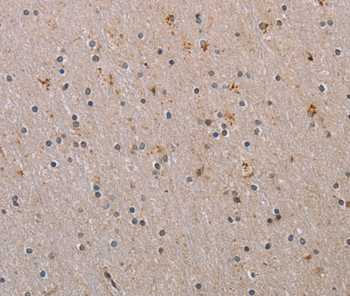 RAB39B Antibody
