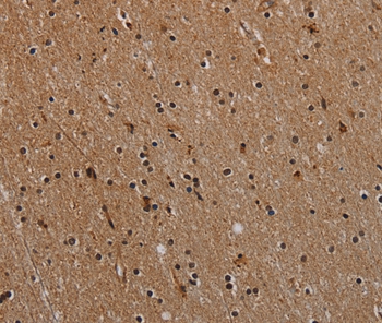 NLRP9 Antibody