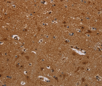PNOC Antibody