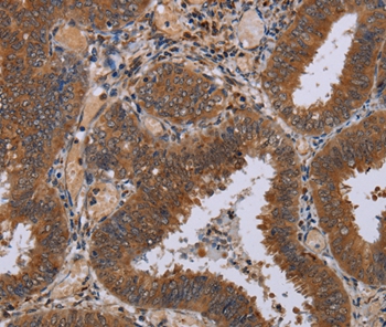 NPTX1 Antibody