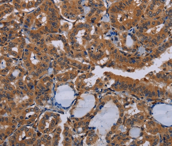 NPTX1 Antibody