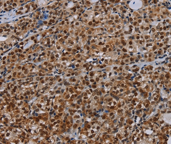 DCAF6 Antibody