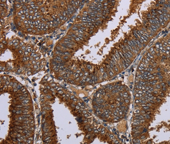C12orf75 Antibody