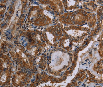 C12orf75 Antibody