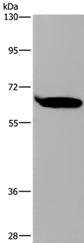 SLC22A2 Antibody