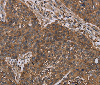 OXTR Antibody