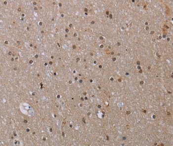 MED12 Antibody