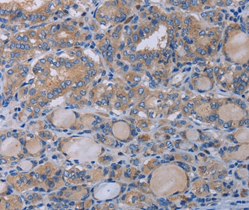 P2RX3 Antibody