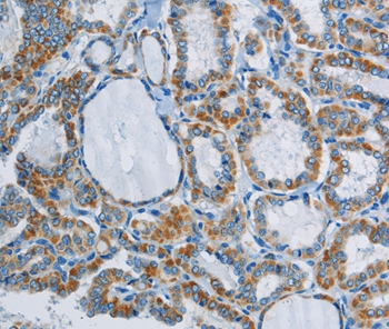 PPARGC1B Antibody