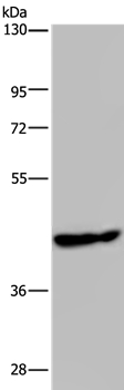 PHKG1 Antibody