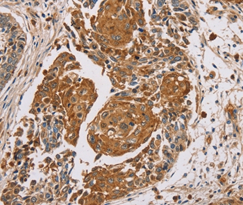 MUC1 Antibody