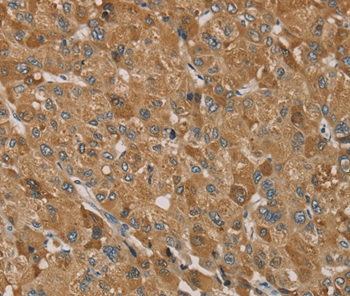 TRIM40 Antibody