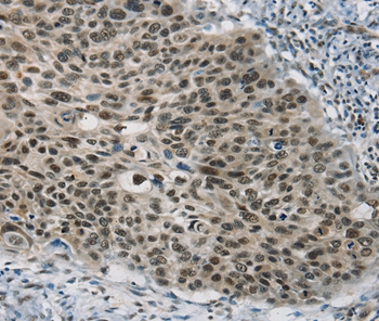 SART3 Antibody