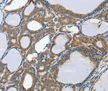 SCD Antibody