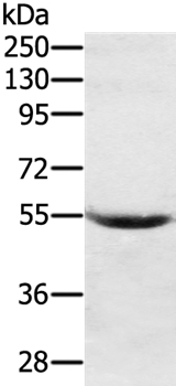 SERPING1  Antibody
