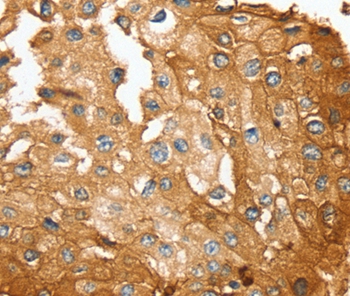 SESN2 Antibody