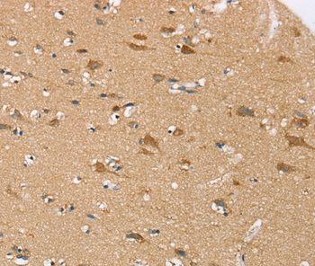 SEZ6L Antibody