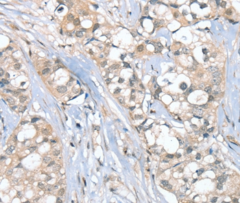 SGPL1 Antibody