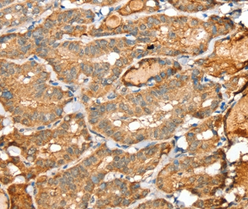 SIGLEC14 Antibody