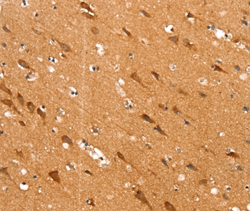 SLC25A12 Antibody