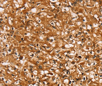 SLC26A6 Antibody