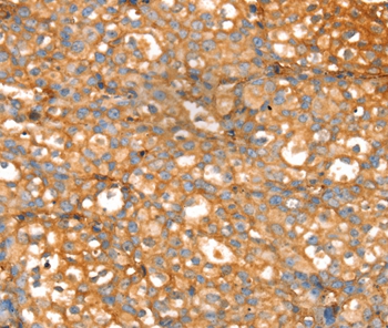 SLC39A9 Antibody