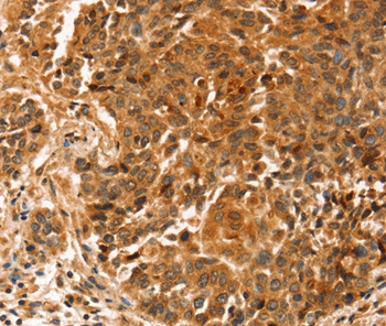 SLC41A2 Antibody