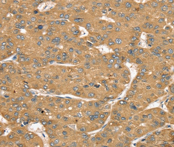 SLIT1 Antibody