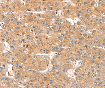 SMOC2 Antibody
