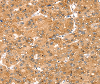 SNX1 Antibody