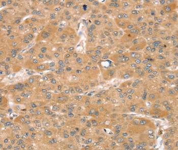 SNX2 Antibody