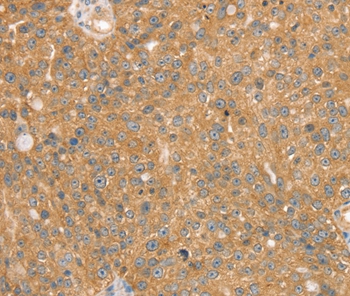 SNX2 Antibody