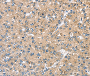 STK32C Antibody