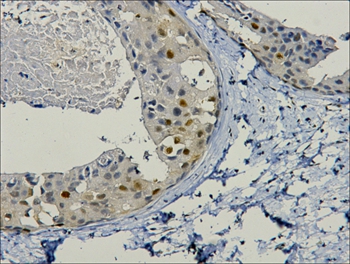 PCNA Mouse Monoclonal Antibody