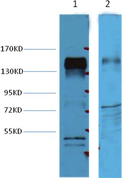 ErbB-2/HER-2 Mouse Monoclonal Antibody