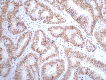 p53 Mouse Monoclonal Antibody