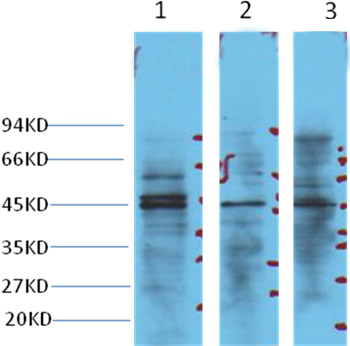 NSE Mouse Monoclonal Antibody